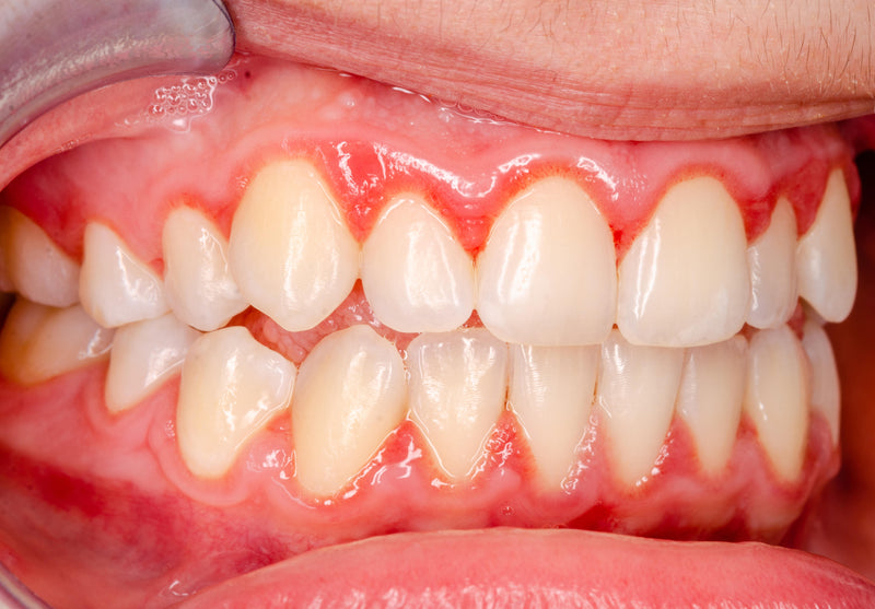 Mouth view demo
